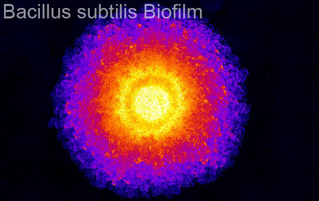 bacterial biofilm mechanics